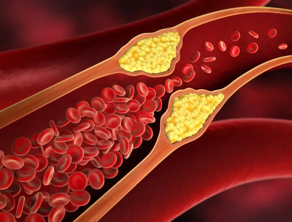 Colesterol HDL