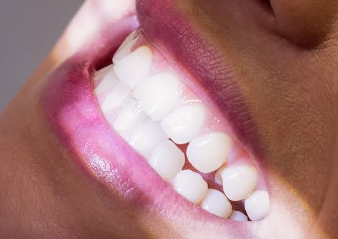 Sonhar com dente caindo