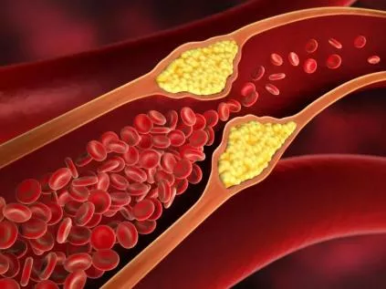 Colesterol HDL: O Guia Definitivo sobre o "Bom" Colesterol e Como Aumentá-lo na Prática