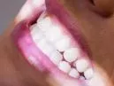 Sonhar com dente caindo: significado, angústia e o que aprendi